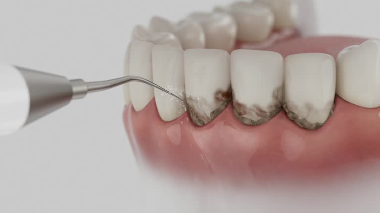 Reliable Dental Implants contractor in Walkertown, NC by Smile Center Dentistry